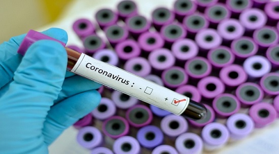 Saúde anuncia primeiro caso confirmado de coronavírus em aldeia indígena de Mato Grosso do Sul